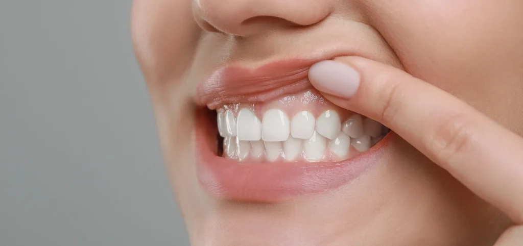 soins gencives Soin des gencives WP2 Template