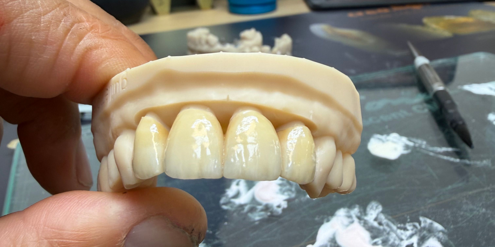 laboratoire dentaire email sante nantes Prothèses fixes Laboratoire Émail Santé